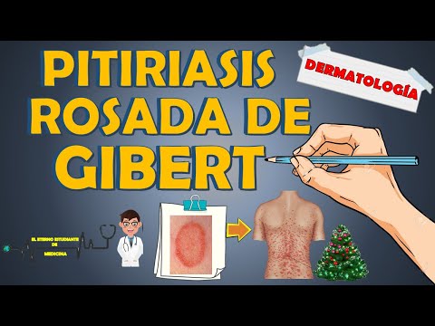 PITIRIASIS ROSADA DE GIBERT ( GILBERT ) - ¿cuánto dura?, clínica, tratamiento📝👨🏻‍⚕️EXPLICACIÓN FÁCIL