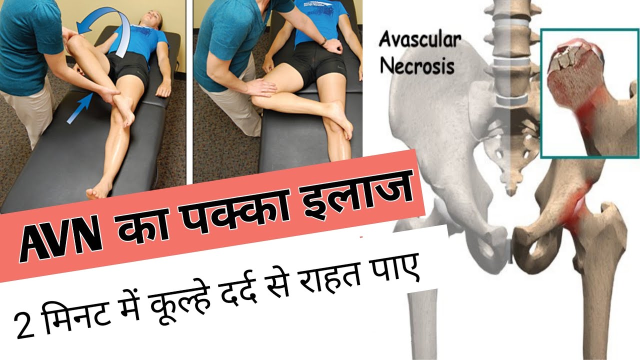 Best exercises for hip pain avascular necrosis treatment without