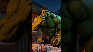 Hulk apna kidney apna Maa Ko nikal kar de diya#hulk #hulkshorts