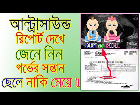 ভিডিও: একটি অনাগত সন্তানের লিঙ্গ সম্পর্কে কীভাবে পূর্বাভাস দেওয়া যায়