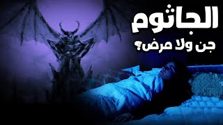 الجاثوم ( شلل النوم)  | شيطان لابسك ام مرض طبيعي ؟ وكيف تتخلص منه ؟!