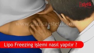 Lipofreezing Nedir ? Lipofreezing Işlemi Nasıl Yapılır ? Lipo Freeze
