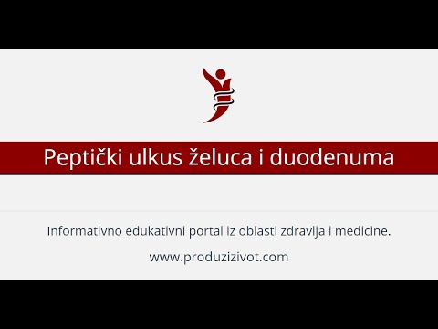 Peptički ulkus želuca i duodenuma