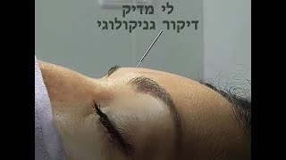 גניקולוגיה סינית