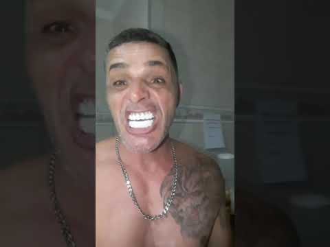 EXPECTATIVA  X  REALIDADE  - Comprou dentadura pela internet