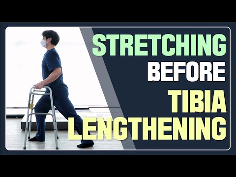 Three stretches before tibia lengthening (pre-op prep 1)