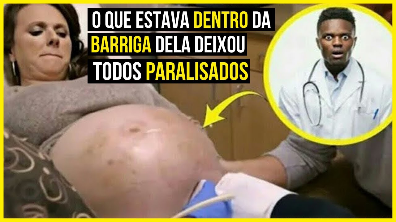 O que ela tinha na barriga nunca tinha sido visto antes neste hospital ...