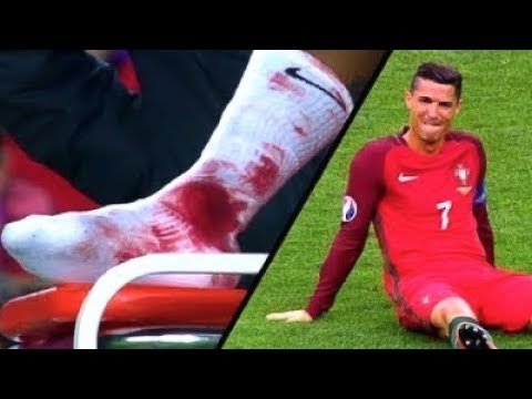 Video: Da li fudbaleri lažiraju povrede?
