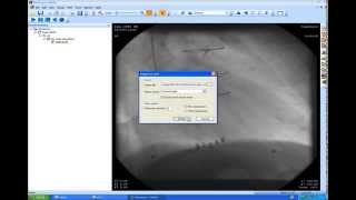 MicroDicom DICOM Viewer 0.0.1