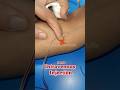 IV Injection Practice || Iv injection technique @nursingpracticallife