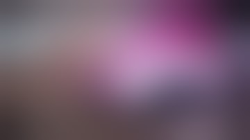 Pyogenic granuloma excission in the human eye