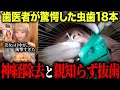 【歯科恐怖症】美女の口に潜む18本虫歯…神経除去&親知らず抜歯の治療がついに開始