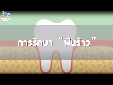 การรักษาฟันร้าว - Skytraindental