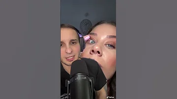 What Is She Popping Chalazion Dermatology Stye 
