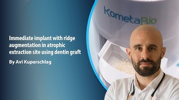 Immediate implant with ridge augmentation in atrophic extraction site using dentin graft