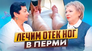 Лечим отек ног в Перми