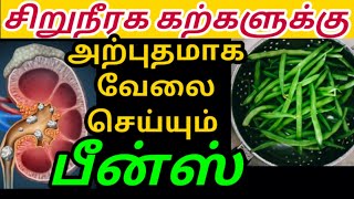 சறநரக கறகள சககரம கரககம பனஸ Beans For Kidney Stone In Tamil Siruneeraga Kal Karaya