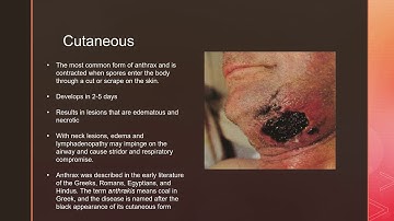 anthrax bioterrorism