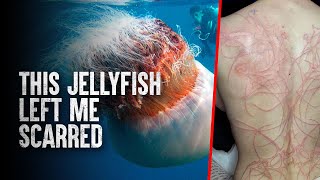 How To Survive The 10 Most Dangerous Jellyfish in the World