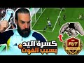 كسرة اليد بسبب الفوت FC25 مباريات الفوت تشامبيونز