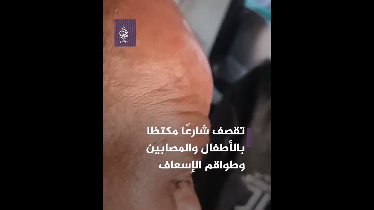طائرات الاحتلال تقـ ـصـ ـف شارعًا مكتظا بالأطفال والمصابين وطواقم الإسعاف
