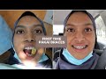 Vlog: Braces Process (Malaysia) | Fatini Rahim