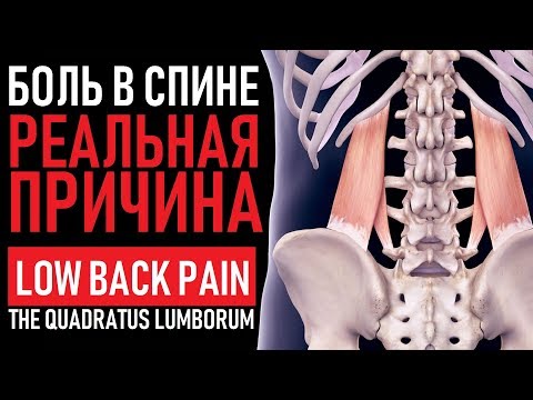 Боль в спине | Квадратная мышца поясницы | Quadratus lumborum pain: Treatment and stretches
