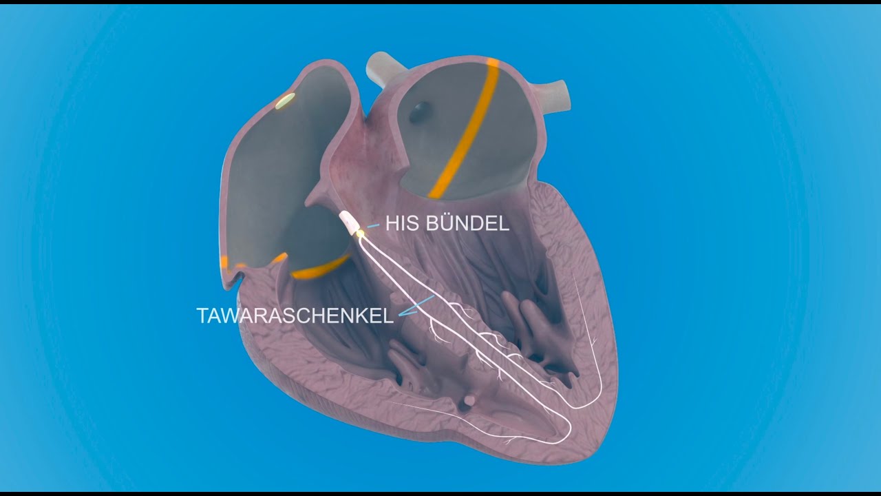 Der Aufbau des Herzens