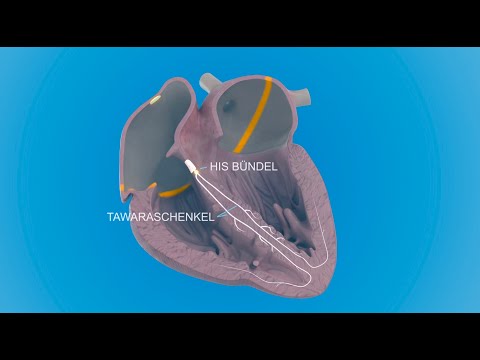 Video: Erzeugung Von Bioartifiziellen Herzen Unter Verwendung Von Dezellularisierten Gerüsten Und Gemischten Zellen