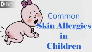 Common Skin Allergies in Children -   Dr. Aruna Prasad