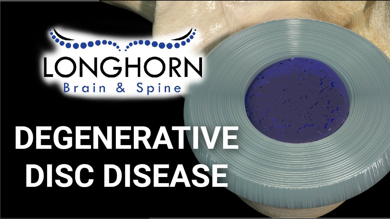 Longhorn Brain & Spine - Degenerative Disc Disease
