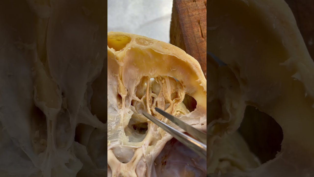 REAL Human Eye And Amazing Muscles