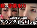 【衝撃】瞼の脂肪取りの整形のダウンタイムと闘う10日間。【ダウンタイムVlog】