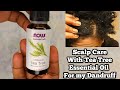 Scalp Care I Purchased This Tea Tree Essential Oil For Dandruff