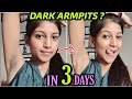 Get Rid of Dark Armpits NATURALLY 😍 100% Works in 3 DAYS