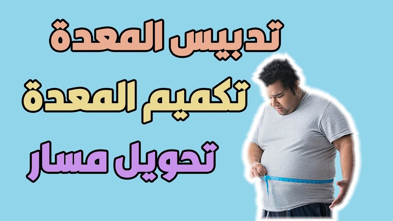 الفرق بين عمليات تدبيس المعدة، تكميم المعدة، تحويل مسار المعدة يشرحه دكتور أحمد السبكي