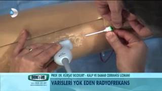 Varisler nasıl yok edilir?