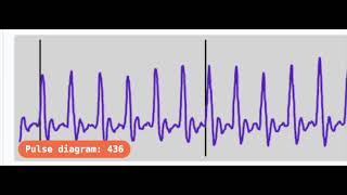 Pulse Sensor Connected to micro:bit