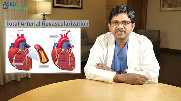 Total Arterial Revascularization | Dr. Prashanth Y M | Aster CMI