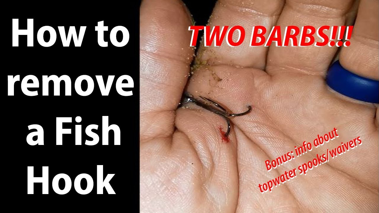 How to remove a Fish Hook. Two Barbs Deep. Bonus topwater lure review YouTube