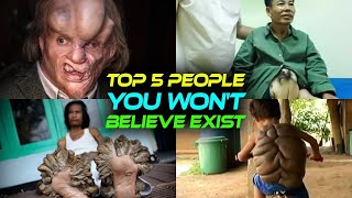 5 People You Won't Believe Existed Till You See Them ( A Must-See Experience )