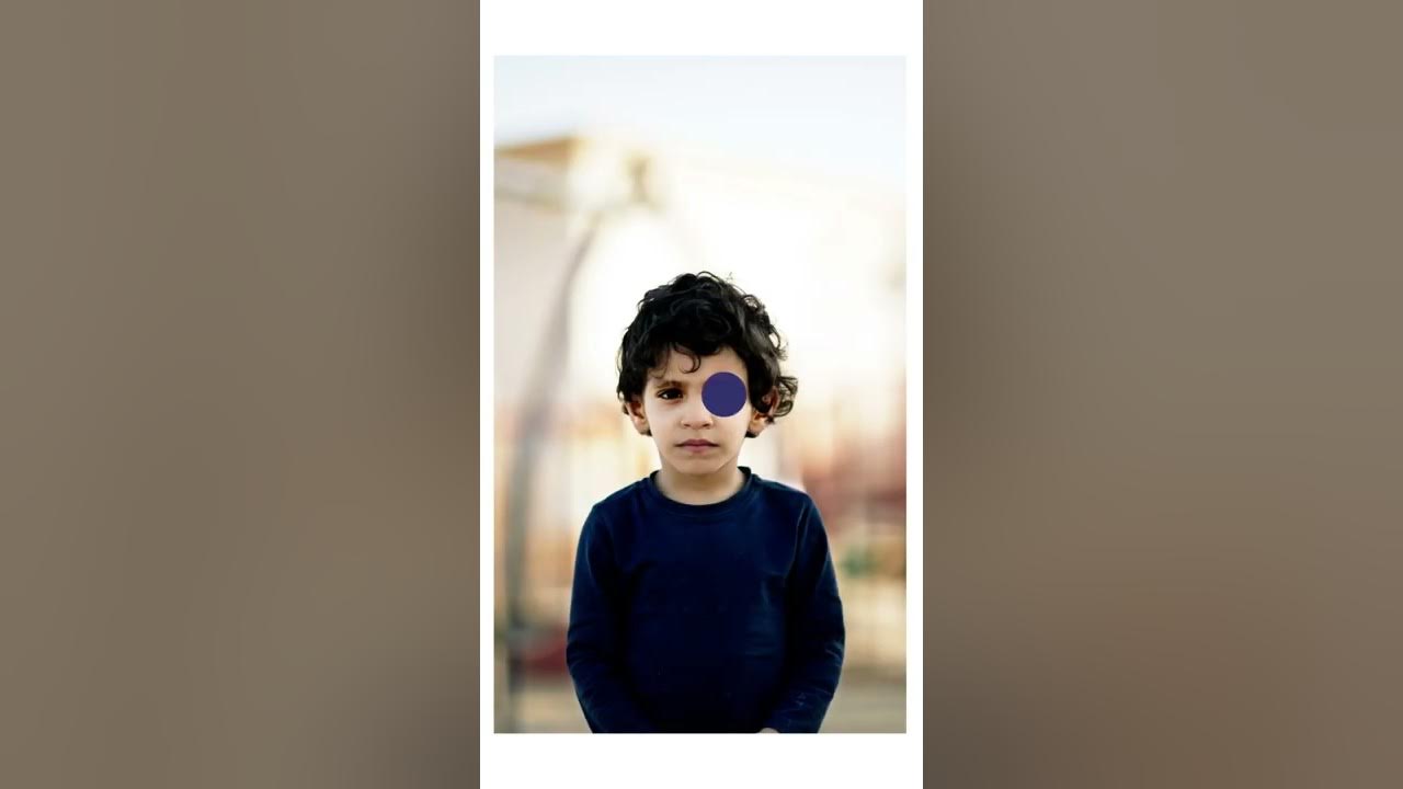 Retinoscopia de Mohindra Chavez Mendoza Melissa Leilany YouTube