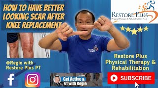 How to Have Better Looking Scar After Knee Replacement
