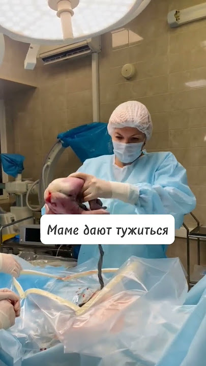 Мягкое КС #акушерствоклуб #мягкиероды #родыбезболи #родысдоулой #акушерка #партнерскиероды #роды