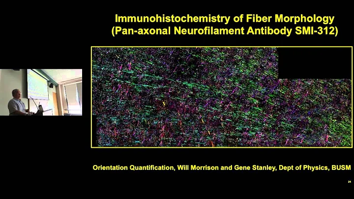Douglas Rosene -  Neuroanatomical and Cellular Cor...