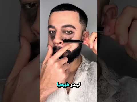رجل يعاني من مرض نادر يجعل وجهه ينمو شعر أسود يومي ا