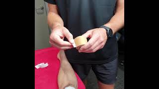 How to stop patella mal-tracking