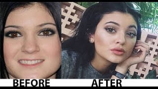 Kylie jenner's lip transformation (plastic surgery?)
#kyliejennerlipchallenge kristen jenner (born august 10, 1997)[1] is
an american reality televisio...