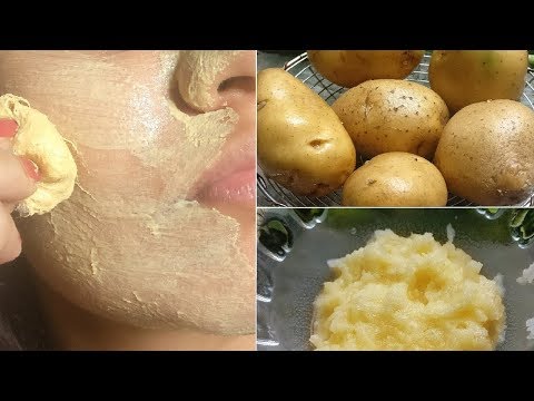 Eine Kartoffelgesichtsmaske entfernt dunkle Flecken und Hyperpigmentierung in 30 Tagen