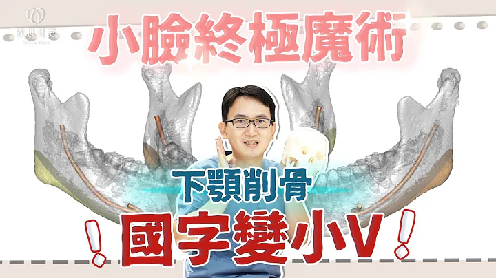 下削骨手术完整解析！哪些人做完下颚线更完美？削骨后遗症公开！｜依心唯美 谢东颖医师 - 天天要闻